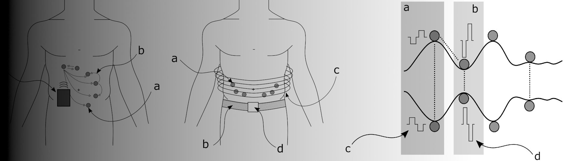 Our patent goes PCT